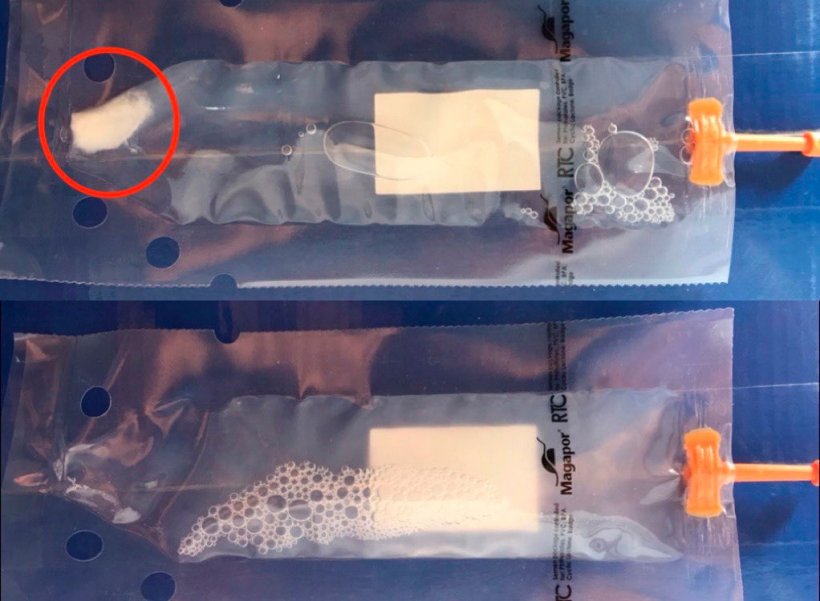 照片2:上图可见精液沉淀,下图可见正确的均匀精液剂量。这种均质化将防止精子活力的丧失,并促进精子在培养基中的更好分布。